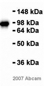 Western blot - Anti-beta Catenin antibody [E247] - ChIP Grade (ab32572), expandable thumbnail