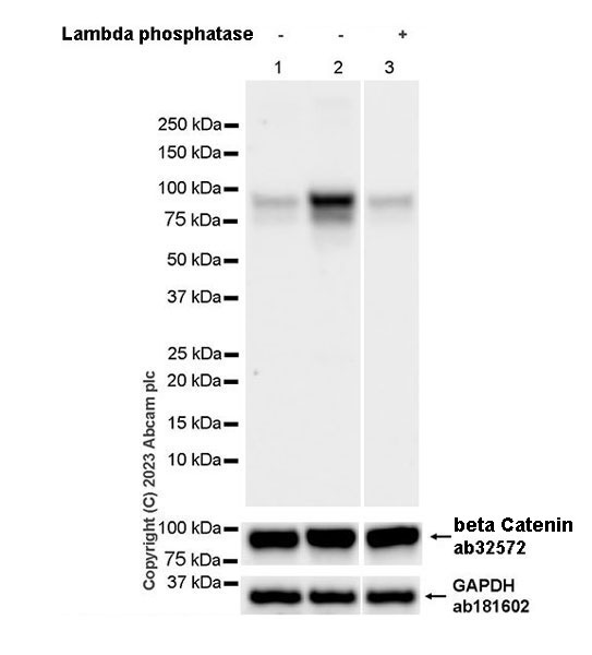 Western blot - Anti-beta Catenin antibody [E247] - ChIP Grade (ab32572), expandable thumbnail