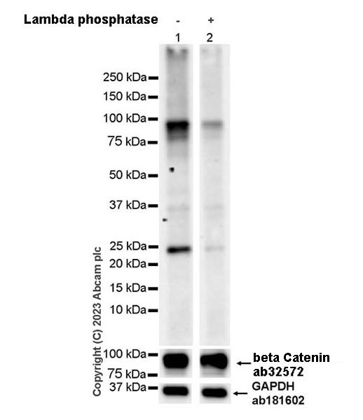 Western blot - Anti-beta Catenin antibody [E247] - ChIP Grade (ab32572), expandable thumbnail