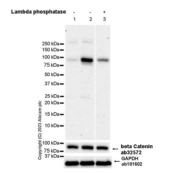 Western blot - Anti-beta Catenin antibody [E247] - ChIP Grade (ab32572), expandable thumbnail