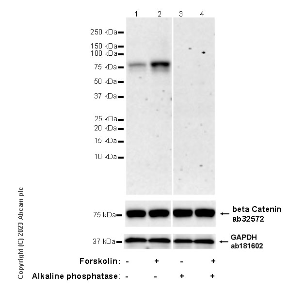 Western blot - Anti-beta Catenin antibody [E247] - ChIP Grade (ab32572), expandable thumbnail