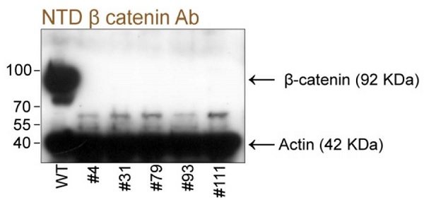 Western blot - Anti-beta Catenin antibody [E247] - ChIP Grade (ab32572), expandable thumbnail
