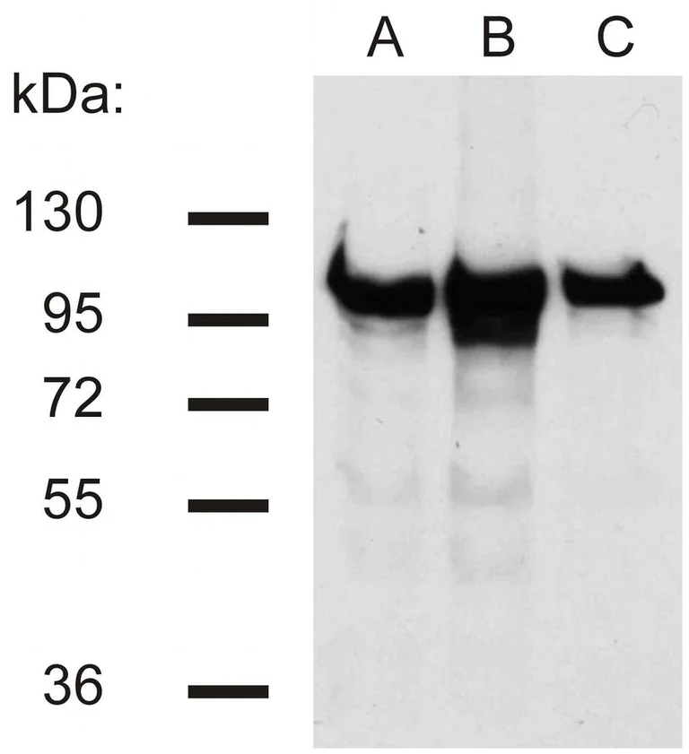 Western blot - Anti-beta Catenin antibody [EM-22] (AB269364)