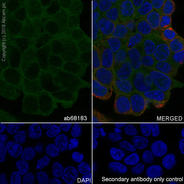 Immunocytochemistry/ Immunofluorescence - Anti-beta Catenin antibody [EP690Y] (AB68183)