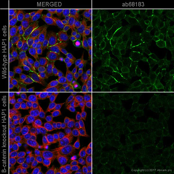 Immunocytochemistry/ Immunofluorescence - Anti-beta Catenin antibody [EP690Y] (AB68183)