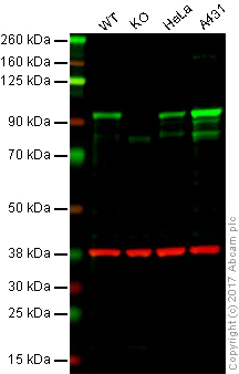 Western blot - Anti-beta Catenin antibody [EP690Y] (AB68183)