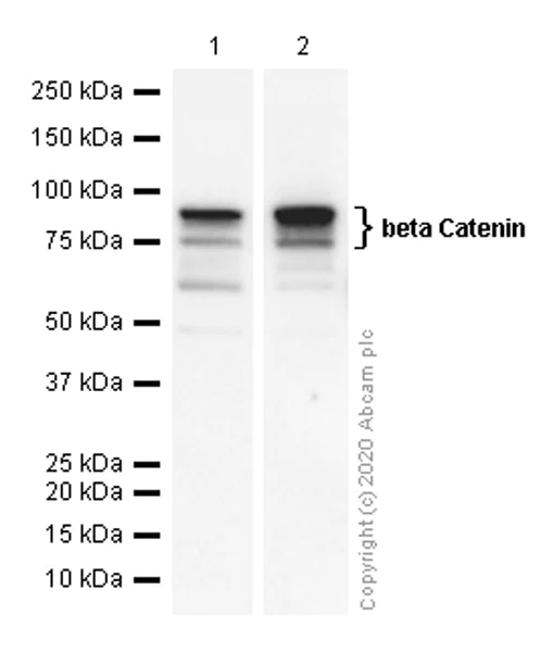 Western blot - Anti-beta Catenin antibody [EP690Y] (AB68183)