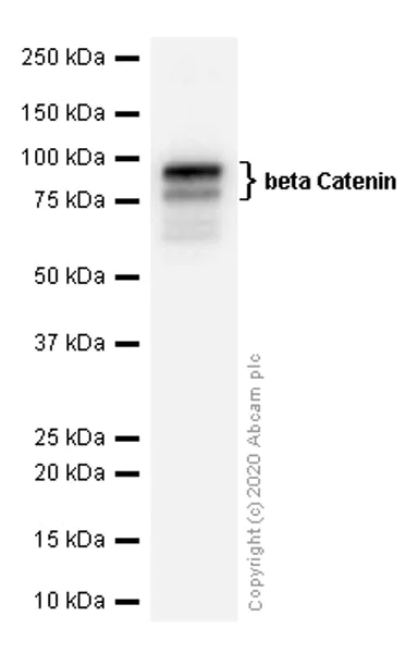 Western blot - Anti-beta Catenin antibody [EP690Y] (AB68183)