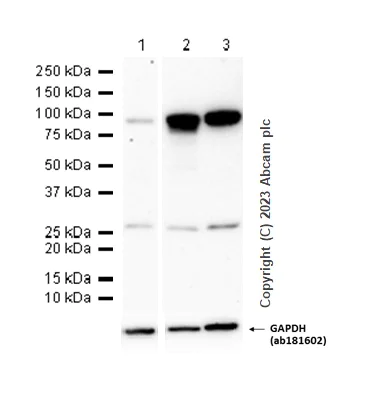 Western blot - Anti-beta Catenin antibody [EP690Y] - BSA and Azide free (AB247372)