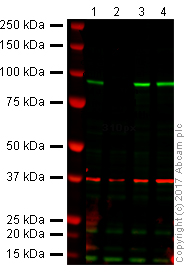Western blot - Anti-beta Catenin antibody [IGX4794R-3] (ab223075), expandable thumbnail