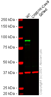 Western blot - Anti-beta Catenin antibody [IGX4794R-3] (ab223075), expandable thumbnail