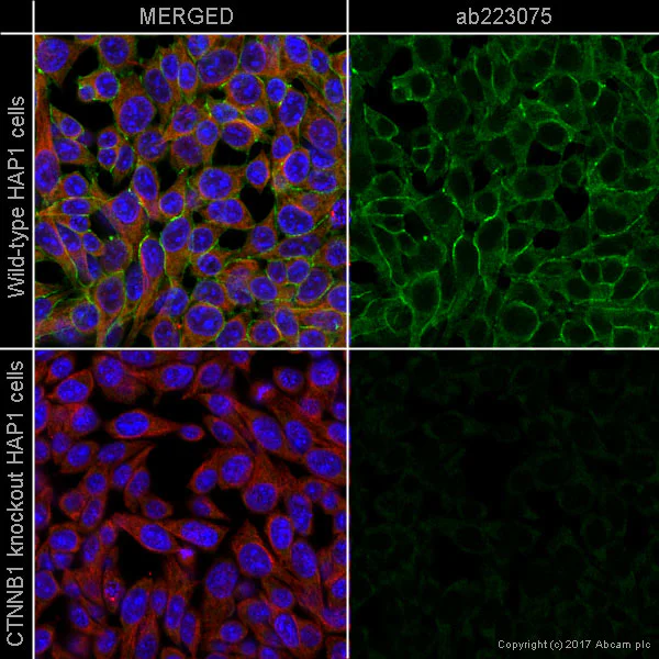 Immunocytochemistry/ Immunofluorescence - Anti-beta Catenin antibody [IGX4794R-3] - BSA and Azide free (AB325977)