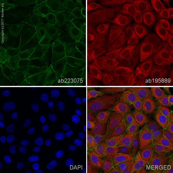 Immunocytochemistry/ Immunofluorescence - Anti-beta Catenin antibody [IGX4794R-3] - BSA and Azide free (AB325977)