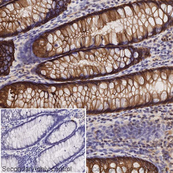 Immunohistochemistry (Formalin/PFA-fixed paraffin-embedded sections) - Anti-beta Catenin antibody [IGX4794R-3] - BSA and Azide free (AB325977)