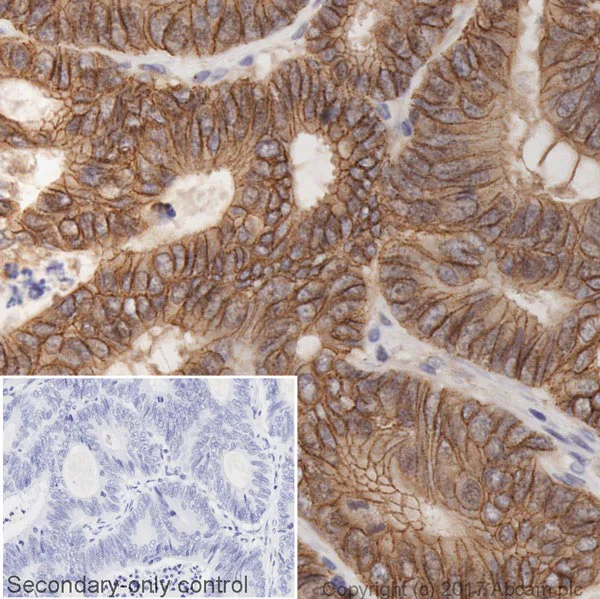 Immunohistochemistry (Formalin/PFA-fixed paraffin-embedded sections) - Anti-beta Catenin antibody [IGX4794R-3] - BSA and Azide free (AB325977)