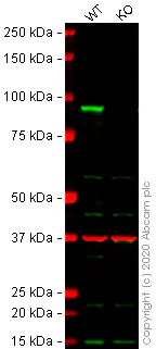 Western blot - Anti-beta Catenin antibody [IGX4794R-3] - BSA and Azide free (AB325977)