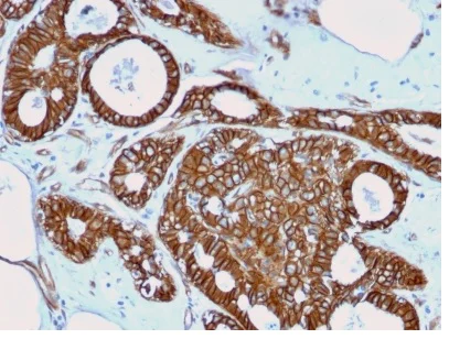 Immunohistochemistry (Formalin/PFA-fixed paraffin-embedded sections) - Anti-beta Catenin antibody [rCTNNB1/2173] (AB237983)