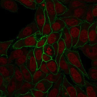 Immunocytochemistry/ Immunofluorescence - Anti-beta Catenin antibody [rCTNNB1/2173] - BSA and Azide free (AB237825)
