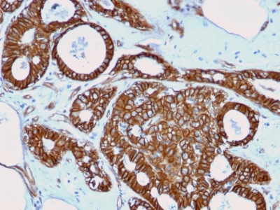 Immunohistochemistry (Formalin/PFA-fixed paraffin-embedded sections) - Anti-beta Catenin antibody [rCTNNB1/2173] - BSA and Azide free (AB237825), expandable thumbnail