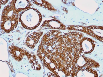 Immunohistochemistry (Formalin/PFA-fixed paraffin-embedded sections) - Anti-beta Catenin antibody [rCTNNB1/2173] - BSA and Azide free (AB237825)