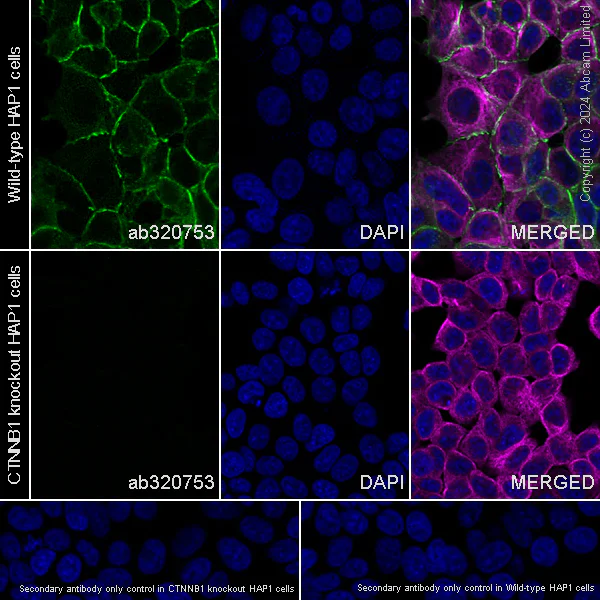 Immunocytochemistry/ Immunofluorescence - Anti-beta Catenin antibody [RM1213] (AB320753)