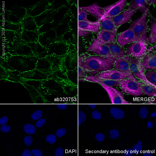 Immunocytochemistry/ Immunofluorescence - Anti-beta Catenin antibody [RM1213] (AB320753)