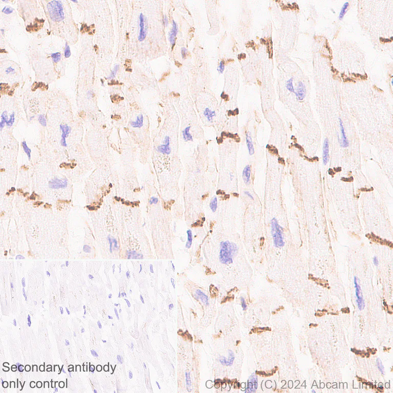 Immunohistochemistry (Formalin/PFA-fixed paraffin-embedded sections) - Anti-beta Catenin antibody [RM1213] (AB320753)