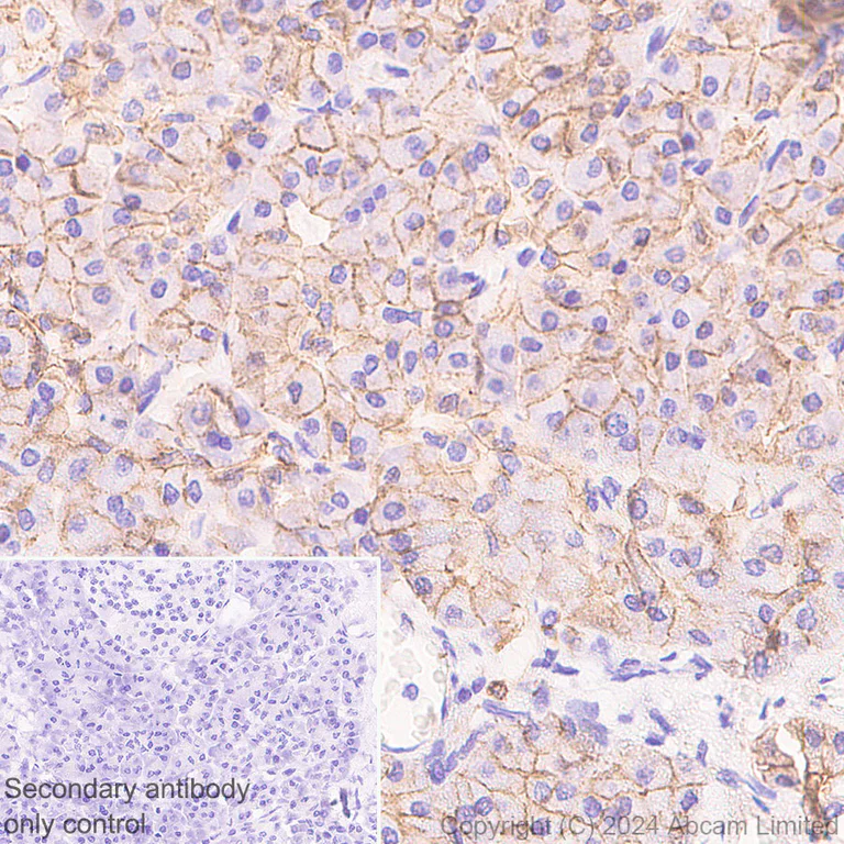 Immunohistochemistry (Formalin/PFA-fixed paraffin-embedded sections) - Anti-beta Catenin antibody [RM1213] (AB320753)