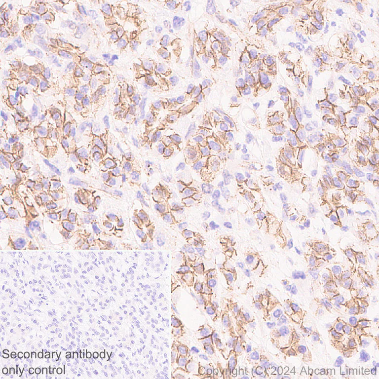 Immunohistochemistry (Formalin/PFA-fixed paraffin-embedded sections) - Anti-beta Catenin antibody [RM1213] (AB320753)