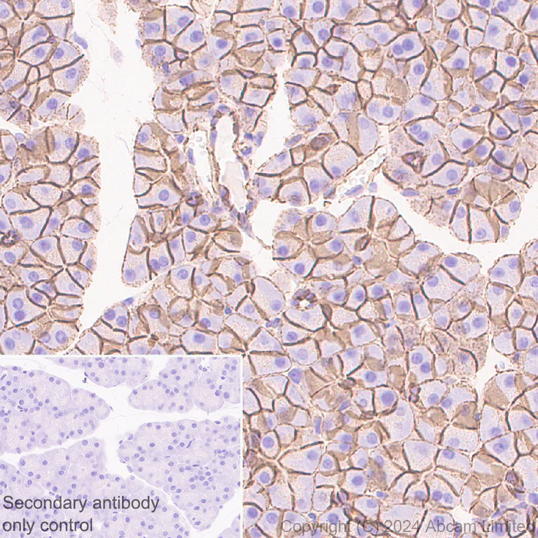 Immunohistochemistry (Formalin/PFA-fixed paraffin-embedded sections) - Anti-beta Catenin antibody [RM1213] (AB320753)