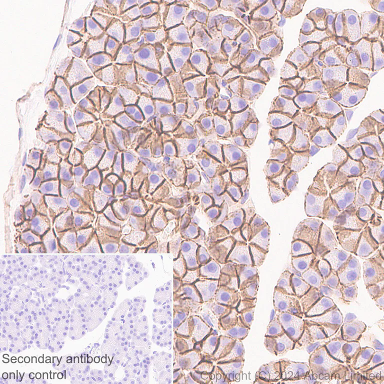Immunohistochemistry (Formalin/PFA-fixed paraffin-embedded sections) - Anti-beta Catenin antibody [RM1213] (AB320753)