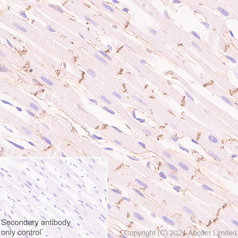 Immunohistochemistry (Formalin/PFA-fixed paraffin-embedded sections) - Anti-beta Catenin antibody [RM1213] (AB320753)