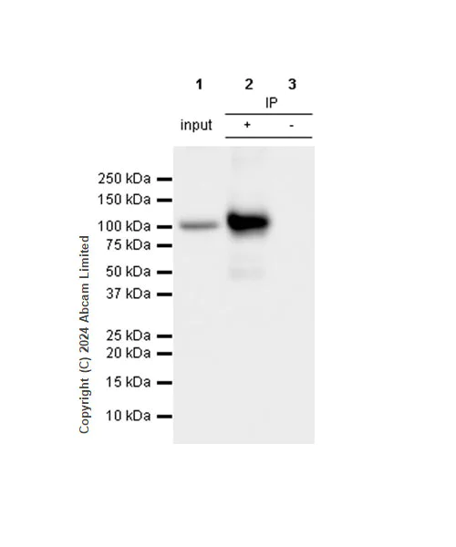 Immunoprecipitation - Anti-beta Catenin antibody [RM1213] (AB320753)