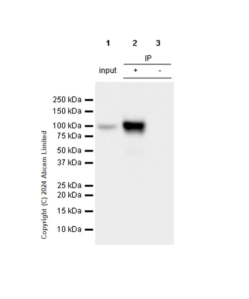 Immunoprecipitation - Anti-beta Catenin antibody [RM1213] (AB320753)