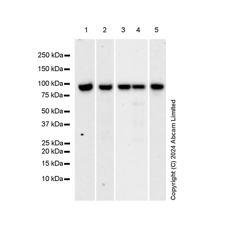 Western blot - Anti-beta Catenin antibody [RM1213] (AB320753)