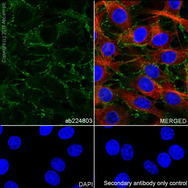 Immunocytochemistry/ Immunofluorescence - Anti-beta Catenin antibody [SP328] (AB224803)