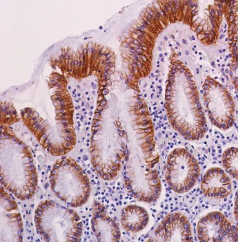 Immunohistochemistry (Formalin/PFA-fixed paraffin-embedded sections) - Anti-beta Catenin antibody [SP328] (AB224803)
