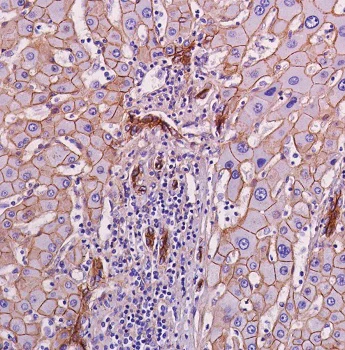 Immunohistochemistry (Formalin/PFA-fixed paraffin-embedded sections) - Anti-beta Catenin antibody [SP328] (AB224803)