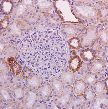 Immunohistochemistry (Formalin/PFA-fixed paraffin-embedded sections) - Anti-beta Catenin antibody [SP328] (AB224803)