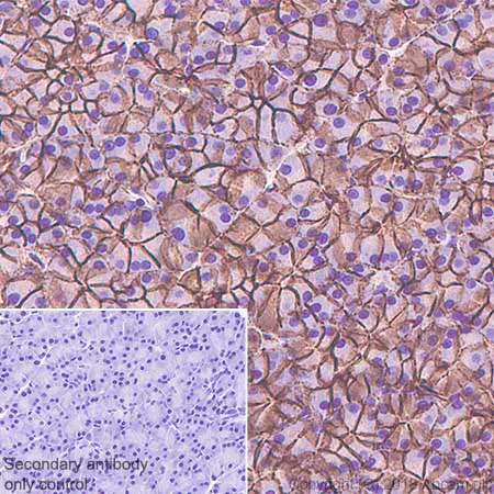 Immunohistochemistry (Formalin/PFA-fixed paraffin-embedded sections) - Anti-beta Catenin antibody [SP328] (AB224803)
