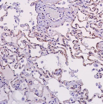 Immunohistochemistry (Formalin/PFA-fixed paraffin-embedded sections) - Anti-beta Catenin antibody [SP328] (AB224803)