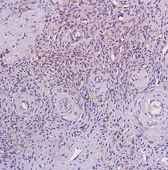 Immunohistochemistry (Formalin/PFA-fixed paraffin-embedded sections) - Anti-beta Catenin antibody [SP328] (AB224803)