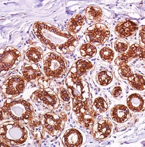 Immunohistochemistry (Formalin/PFA-fixed paraffin-embedded sections) - Anti-beta Catenin antibody [SP328] (AB224803)