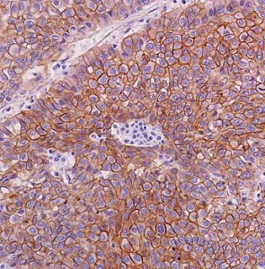 Immunohistochemistry (Formalin/PFA-fixed paraffin-embedded sections) - Anti-beta Catenin antibody [SP328] (AB224803)