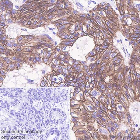 Immunohistochemistry (Formalin/PFA-fixed paraffin-embedded sections) - Anti-beta Catenin antibody [SP328] (AB224803)