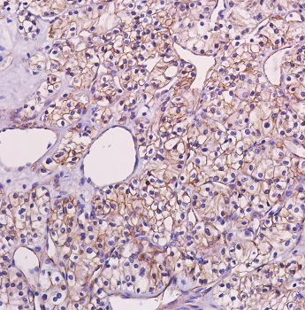 Immunohistochemistry (Formalin/PFA-fixed paraffin-embedded sections) - Anti-beta Catenin antibody [SP328] (AB224803)