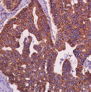Immunohistochemistry (Formalin/PFA-fixed paraffin-embedded sections) - Anti-beta Catenin antibody [SP328] (AB224803)