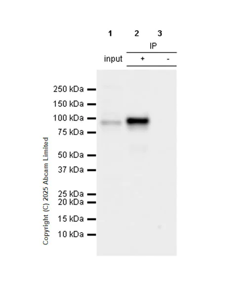 Immunoprecipitation - Anti-beta Catenin antibody [SP328] (AB224803)