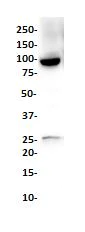 Western blot - Anti-beta Catenin antibody [SP328] (AB224803)