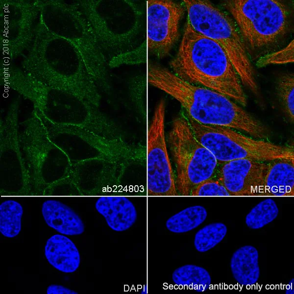 Immunocytochemistry/ Immunofluorescence - Anti-beta Catenin antibody [SP328] - BSA and Azide free (AB242424)
